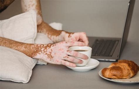 Maladie de la gaufre bleue : Un mème fictif